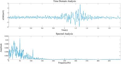 Improved multi-layer wavelet transform and blind source separation based ECG artifacts removal algorithm from the sEMG signal: in the case of upper limbs
